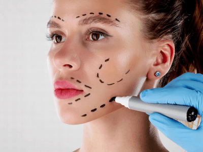 Harmonização Facial