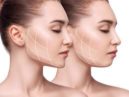 Contorno Mandibular: o que é, tratamentos e resultados