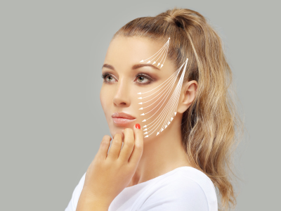 Fios de Sustentação