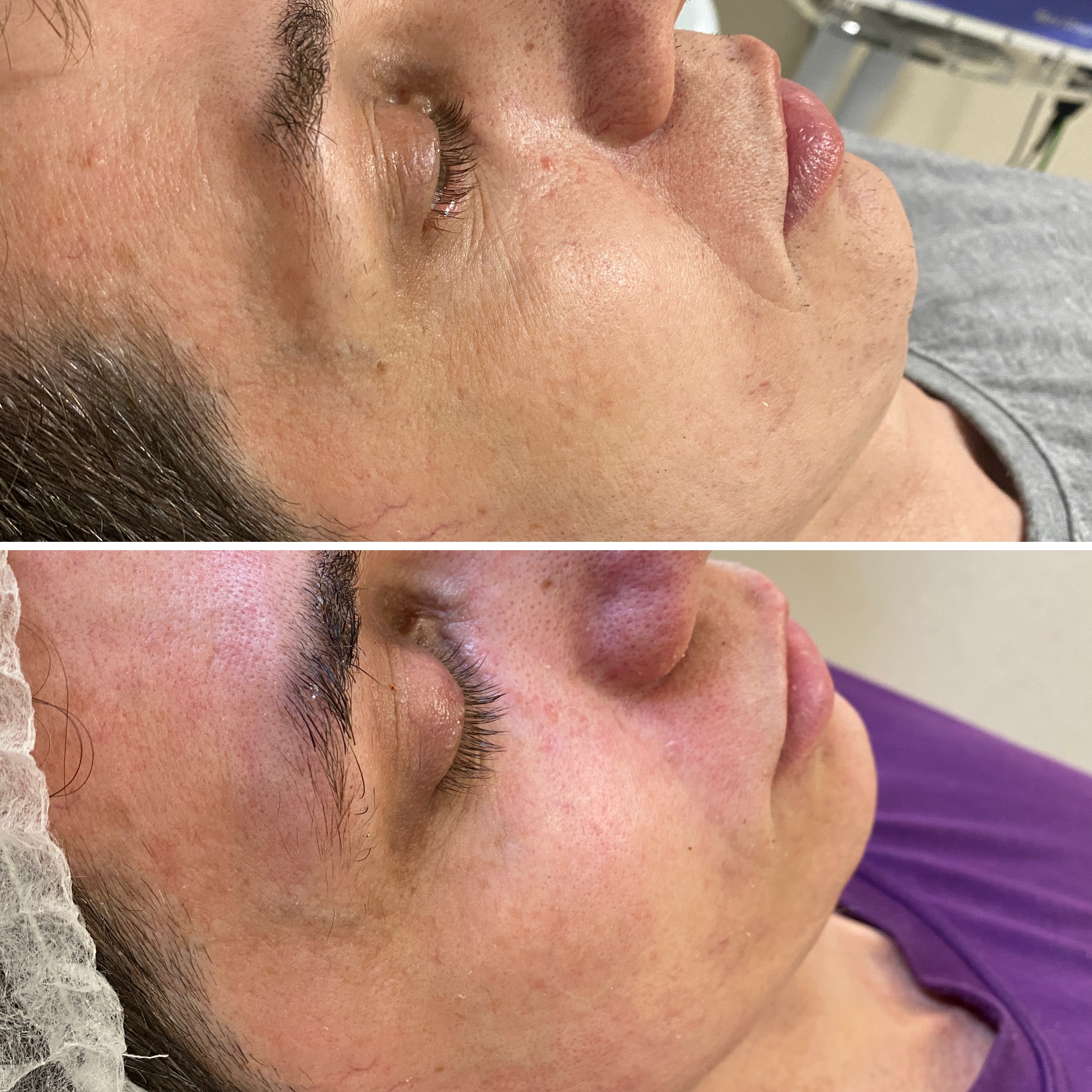 Resultado Skinbooster